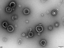 外泌体电镜照片 2023 小.png