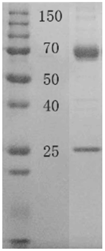 胶图-4D2鼠抗PCT单克隆抗体.png