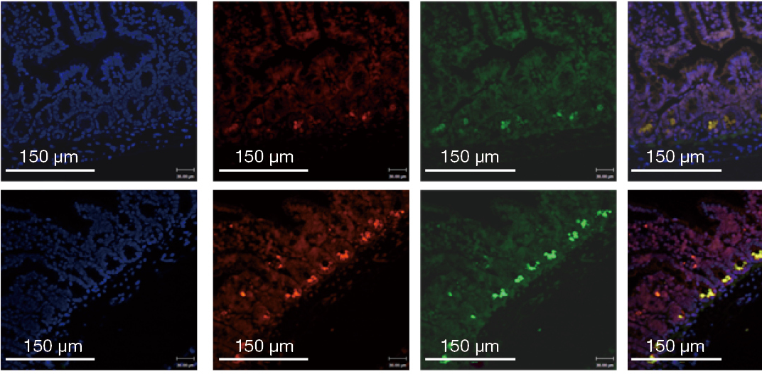 菌株Clostridium butyricum-EUB338共染.png