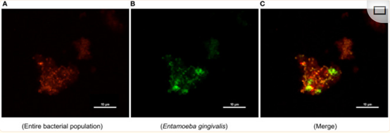 菌株Entamoeba gingivalis-EUB338共染.png