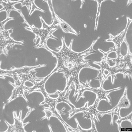 Hep-55.1C Cells.png