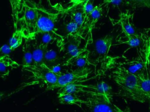 原代人视网膜微血管内皮细胞Cell Systems  #ACBRI 181